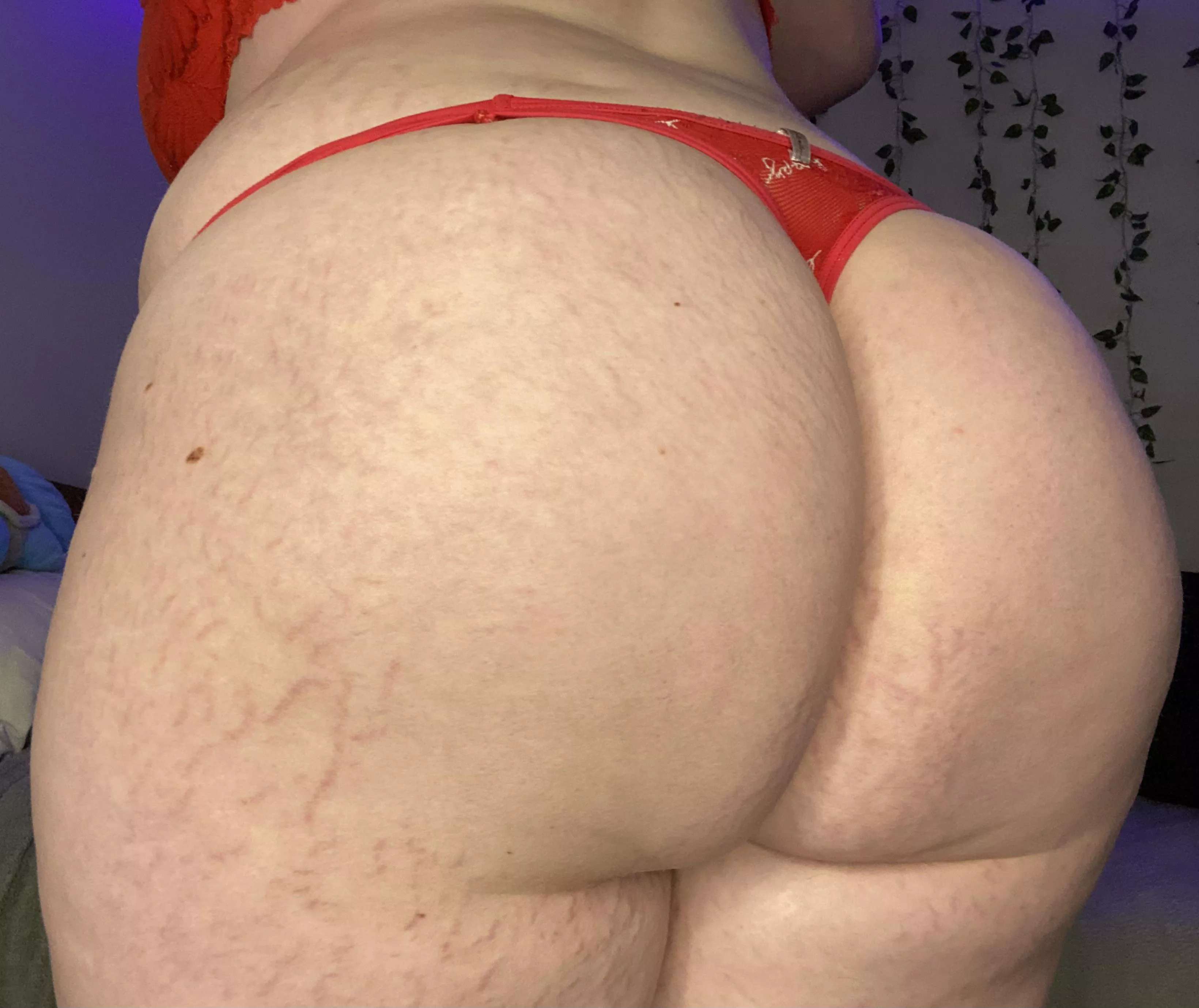Stretch marks for days