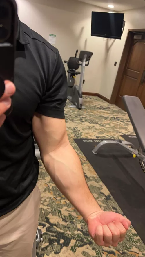 the veins are coming out