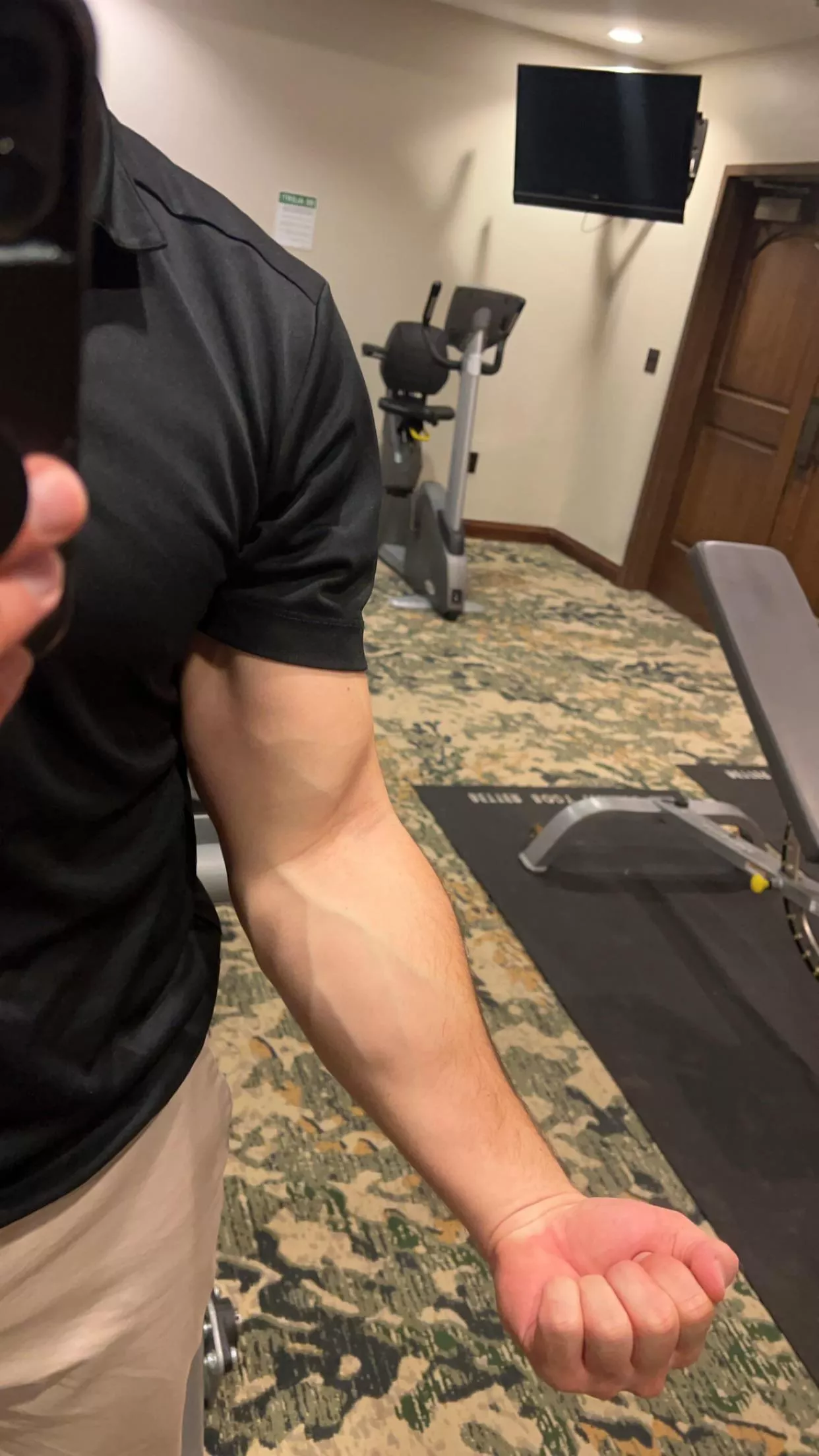the veins are coming out