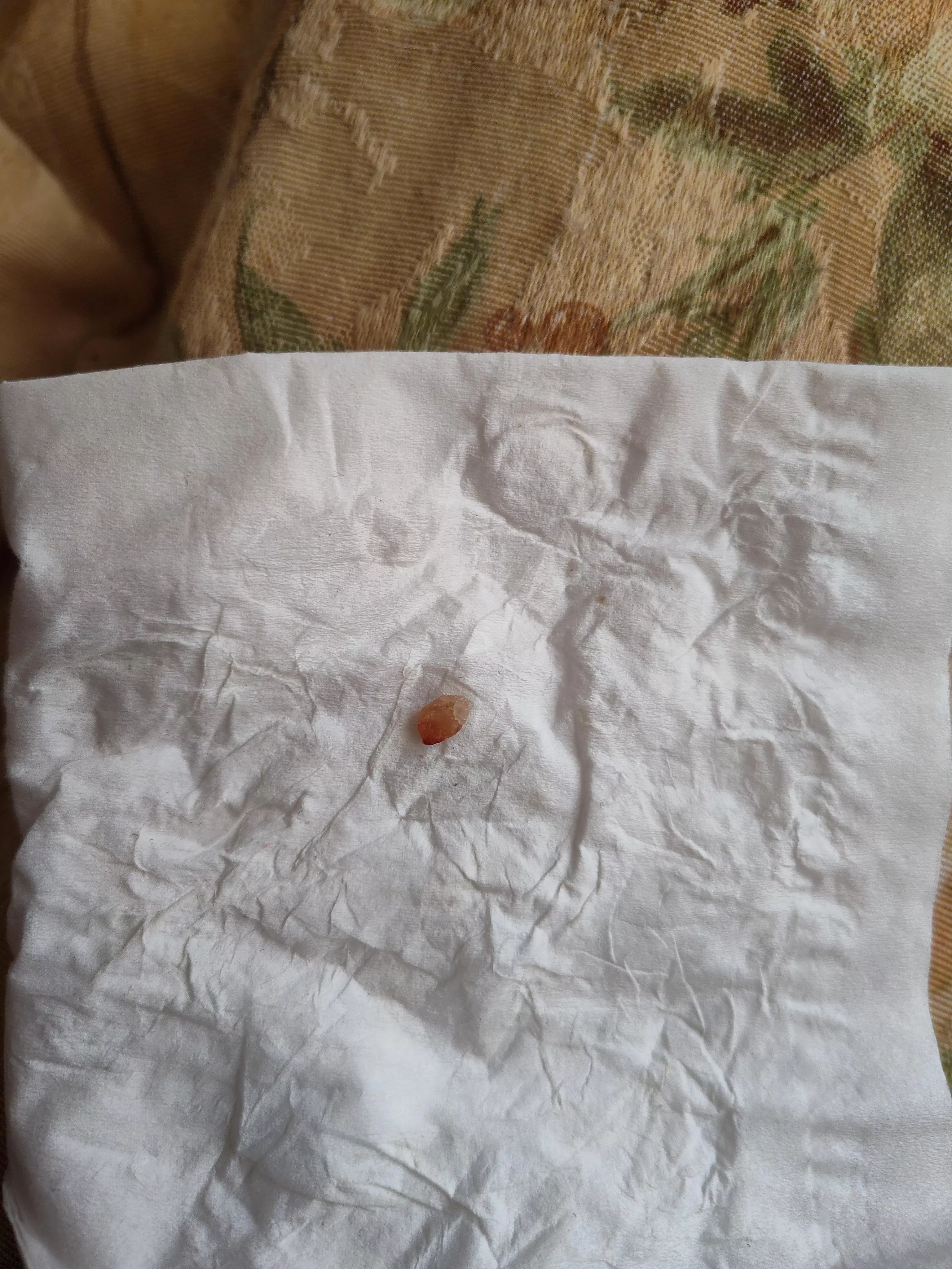 A rather odd cyst core.