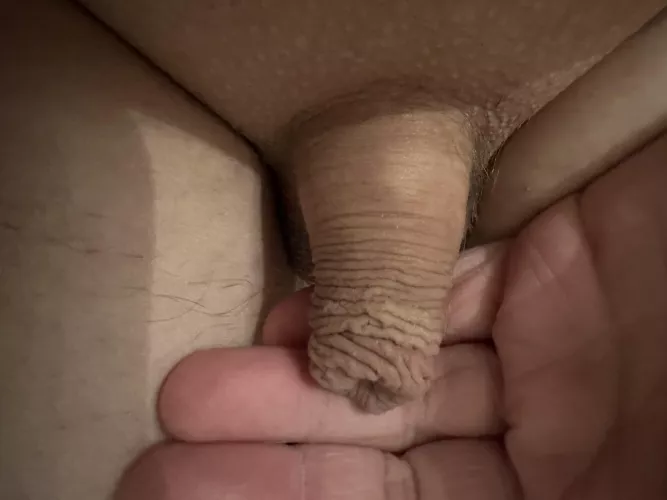 My uncut micropenis