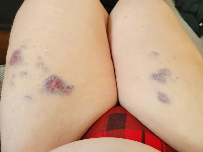 Amateur masochist here — received a nice flogging by my  domme :)