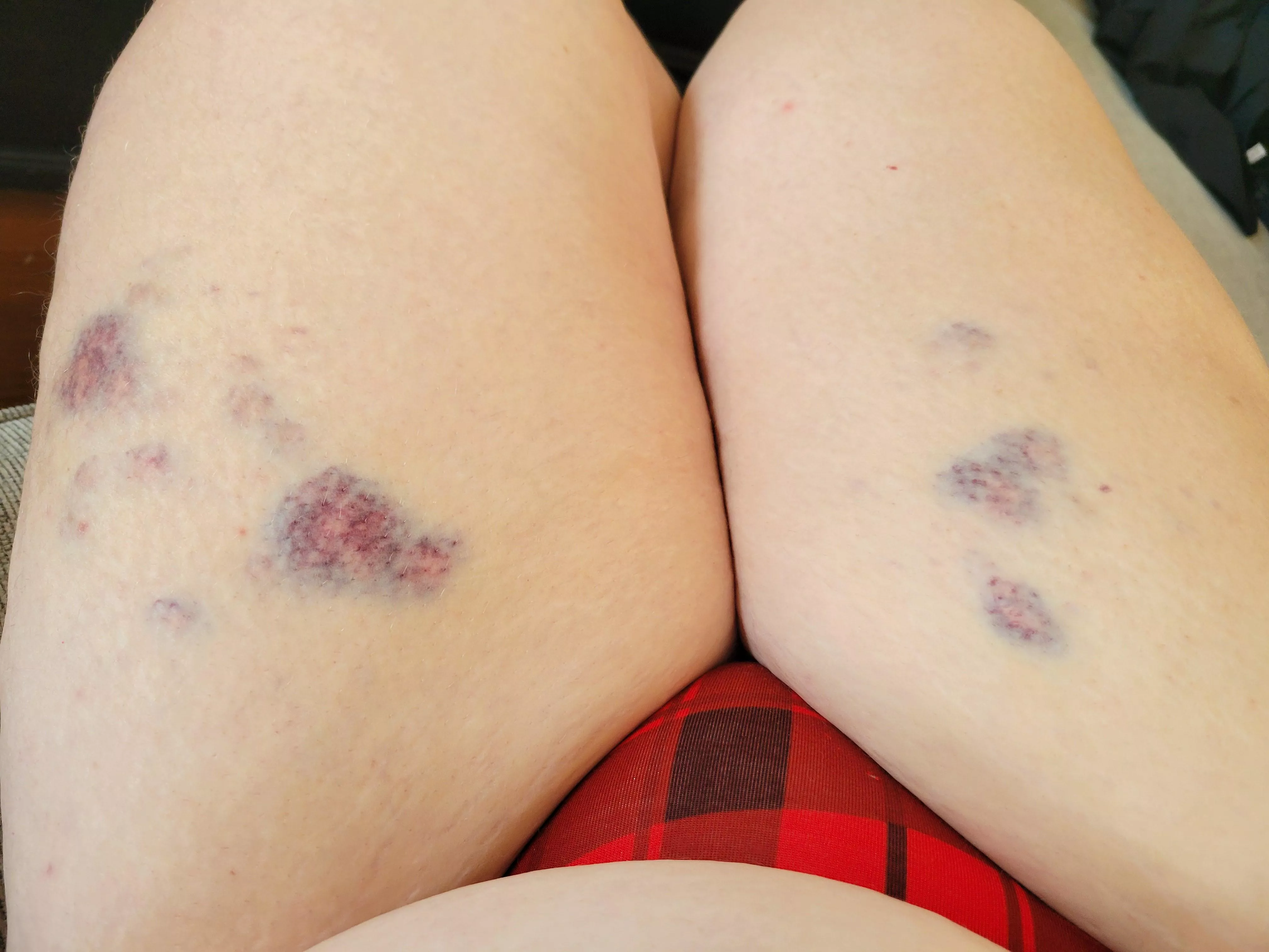 Amateur masochist here — received a nice flogging by my  domme :)