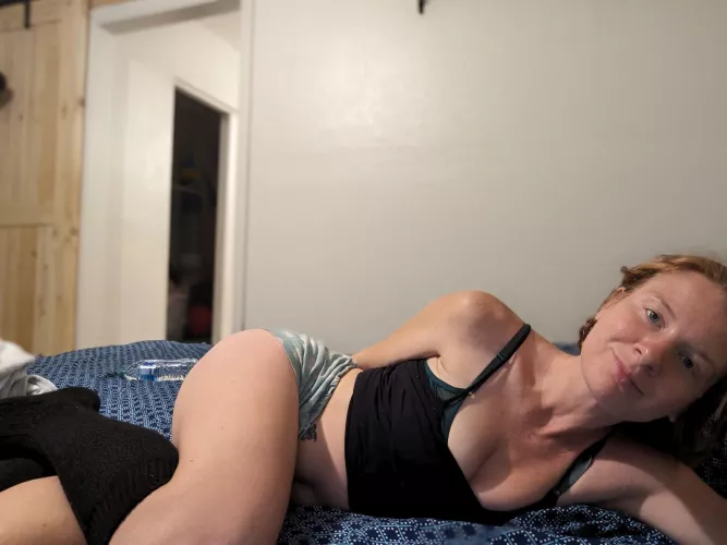 Freckle-fueled firecracker