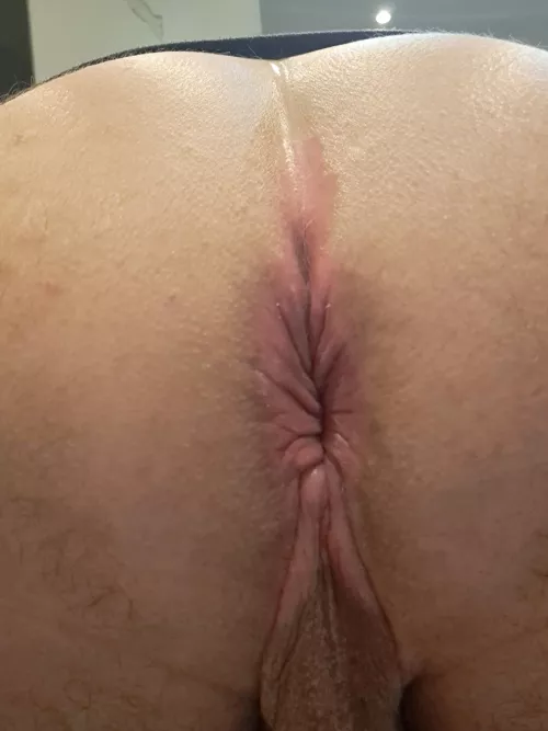 My hole
