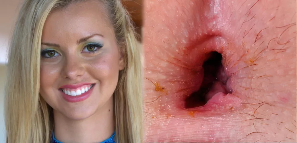 Pretty face, pretty hole