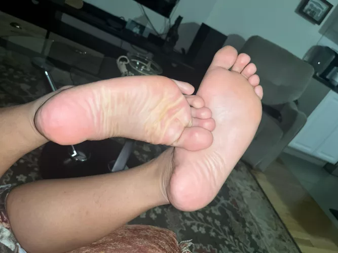 Rub your face in them until u go numb😍😍🦶🏽🦶🏽