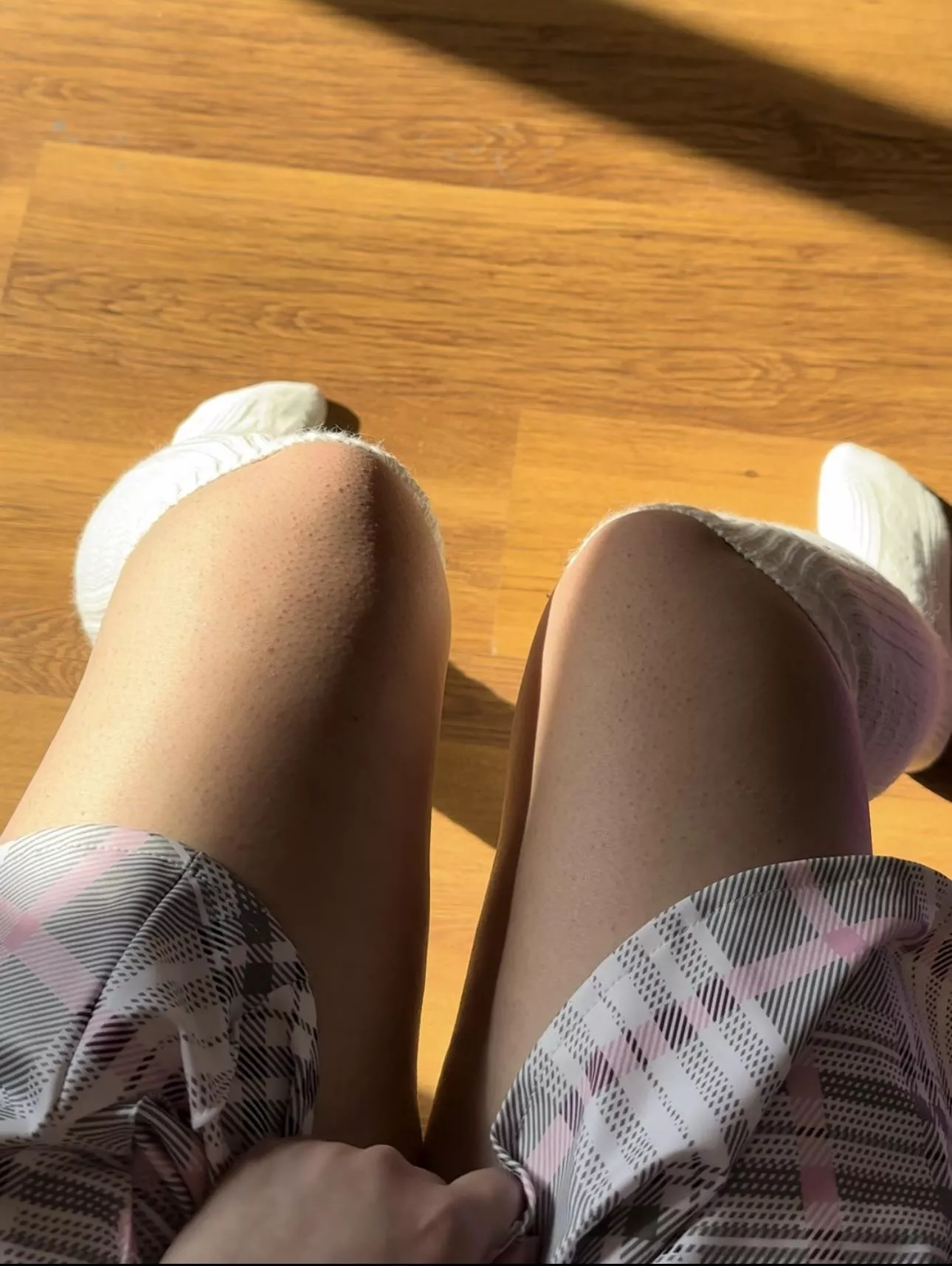 I'm so embarrassed 🙈🙈🙈