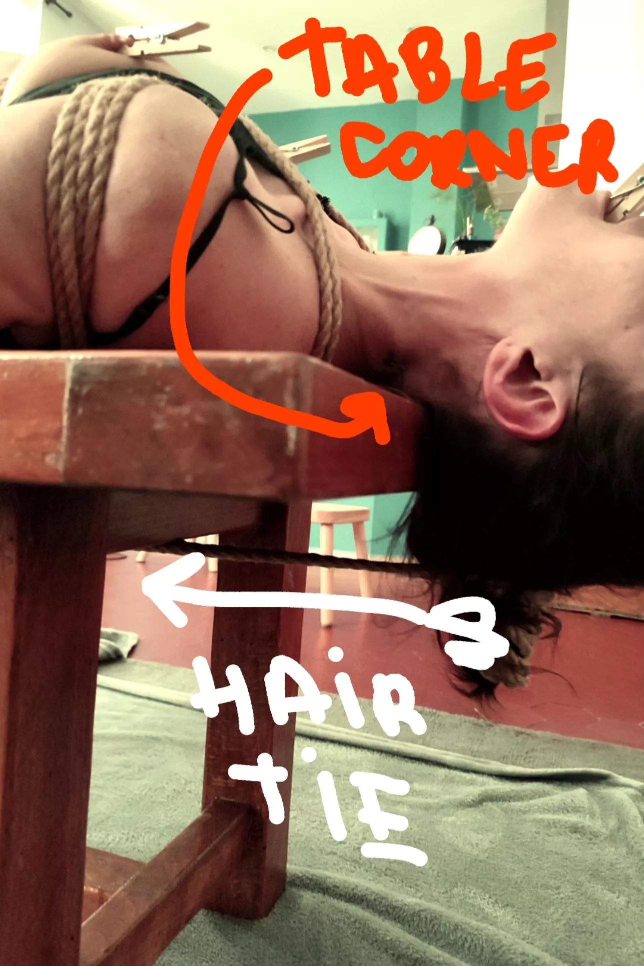 Moderate cranial numbness  ??