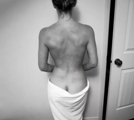 My back after a shower