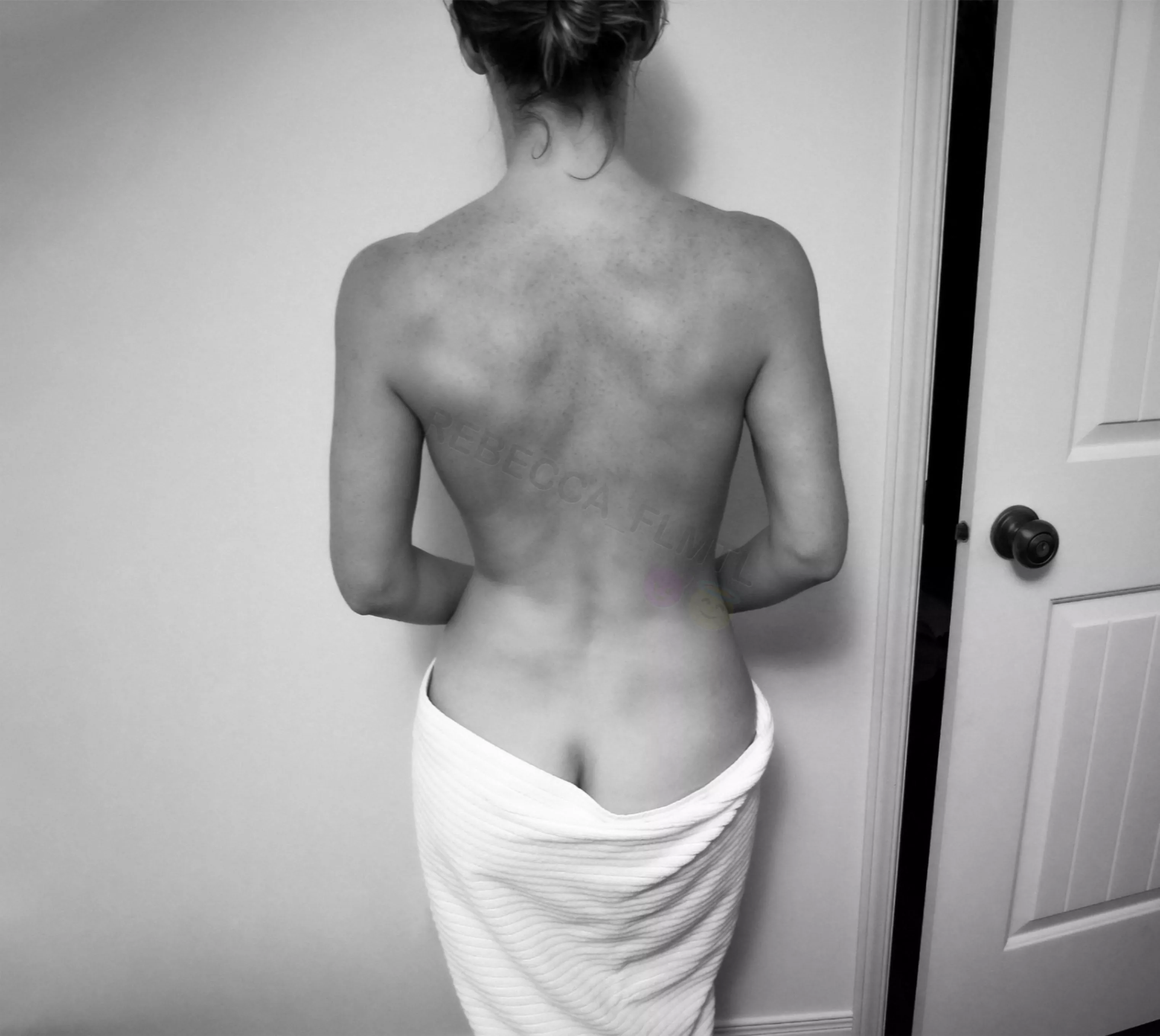 My back after a shower