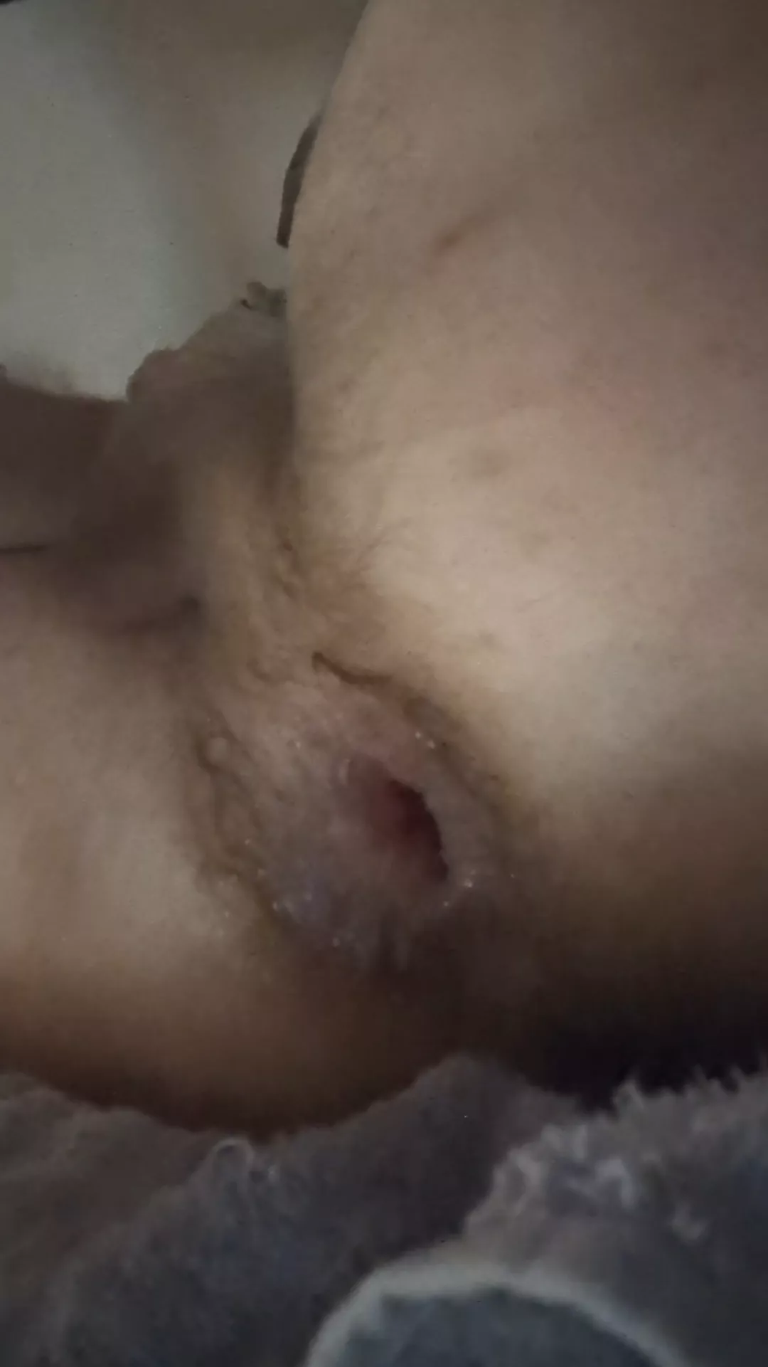 My gaping hole