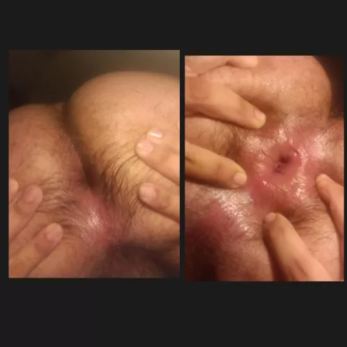 Before and after getting wreck 