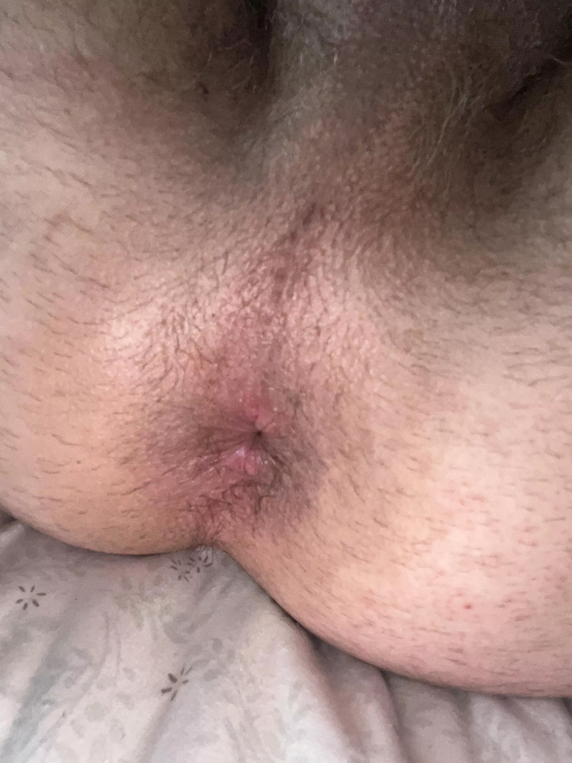 Freshly fucked hole. It still needs more dick