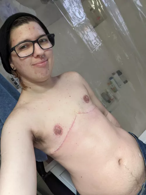 I love being shirtless even more after surgery. ❤️