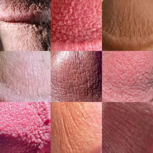 I’m creating a collage of various cut cock glans textures. Hoping to create a 9x9 grid at least. Dm me if you want to be added to the cut quilt!