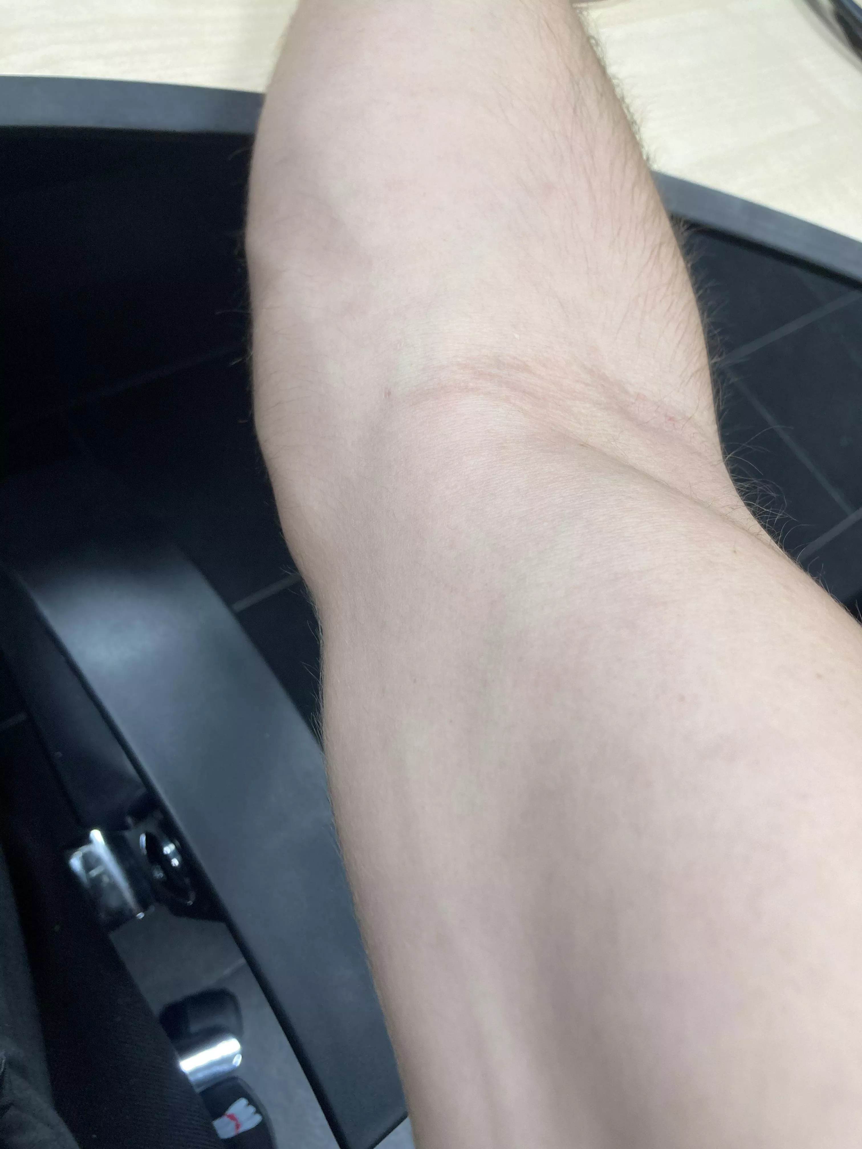 work veins