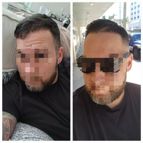 (38m) Before and after 