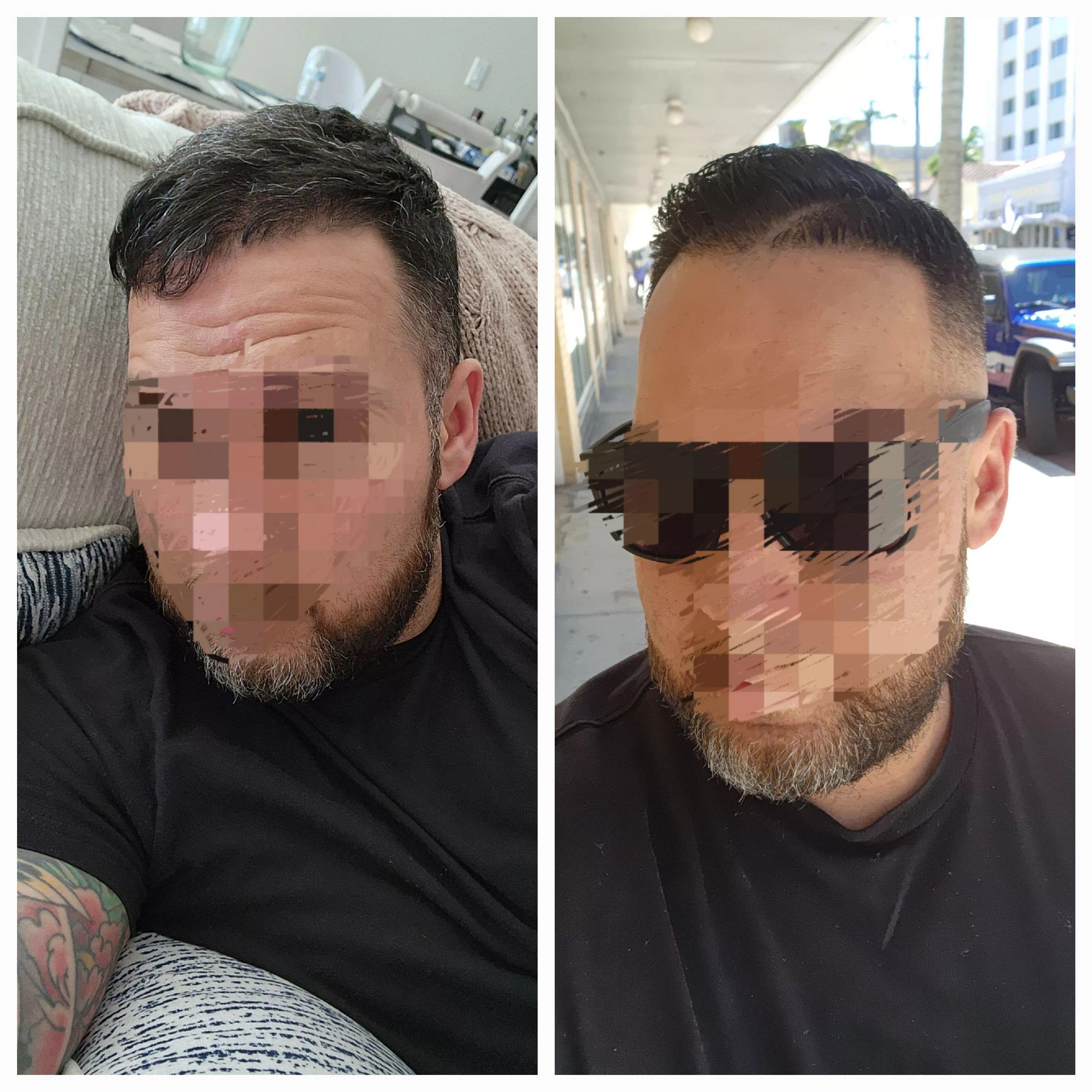 (38m) Before and after 