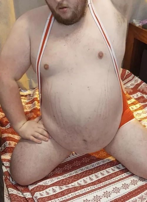 Are stretchmarks unattractive ? 