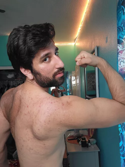 I got a lot of bacne but my back has never been this toned ever😩🙏