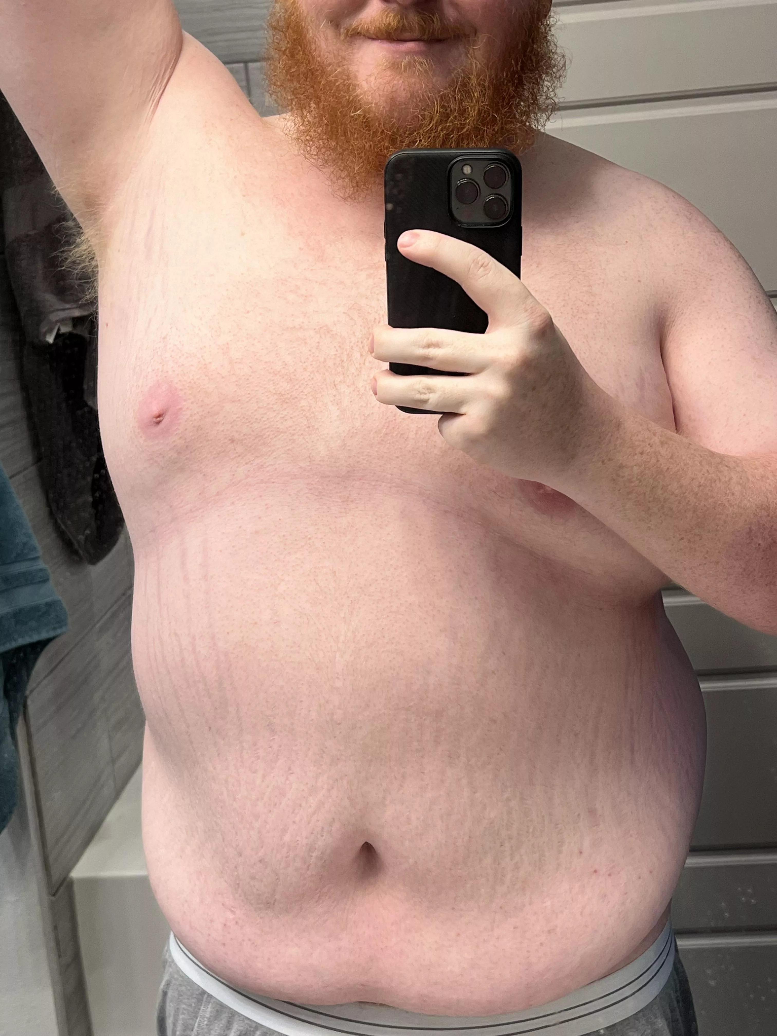 Showing off my tiger stripes this morning