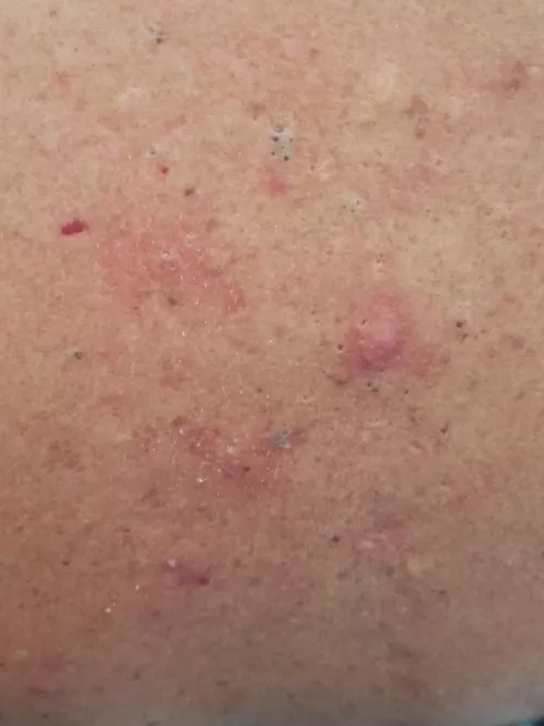 The back of a family friend