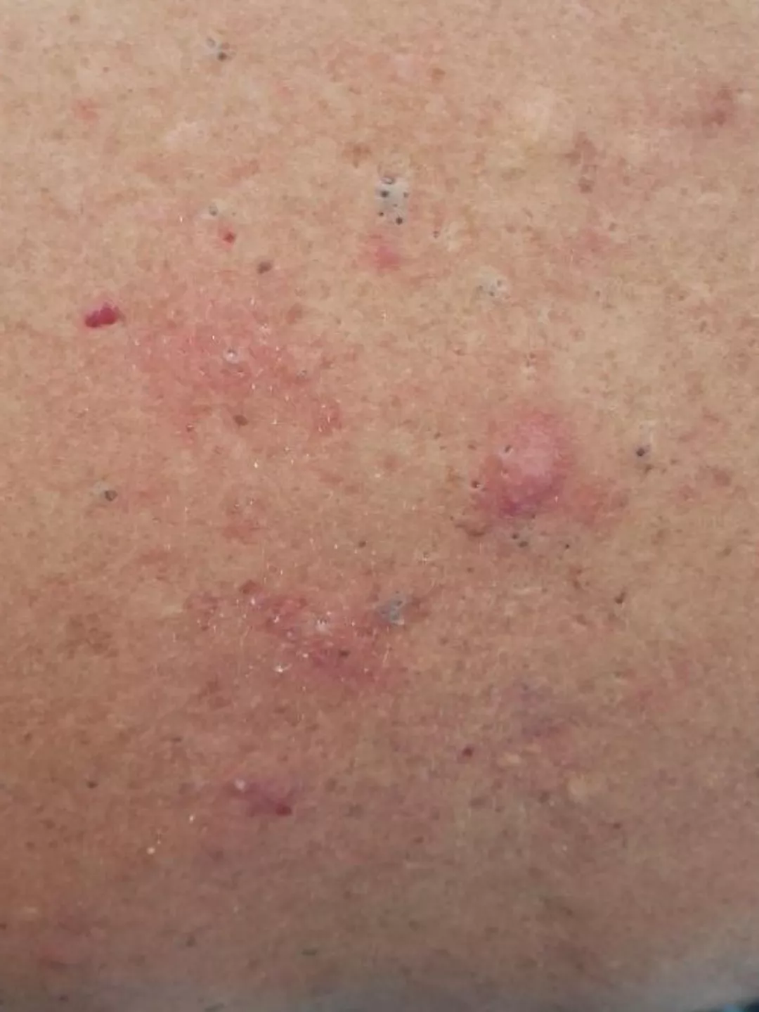 The back of a family friend