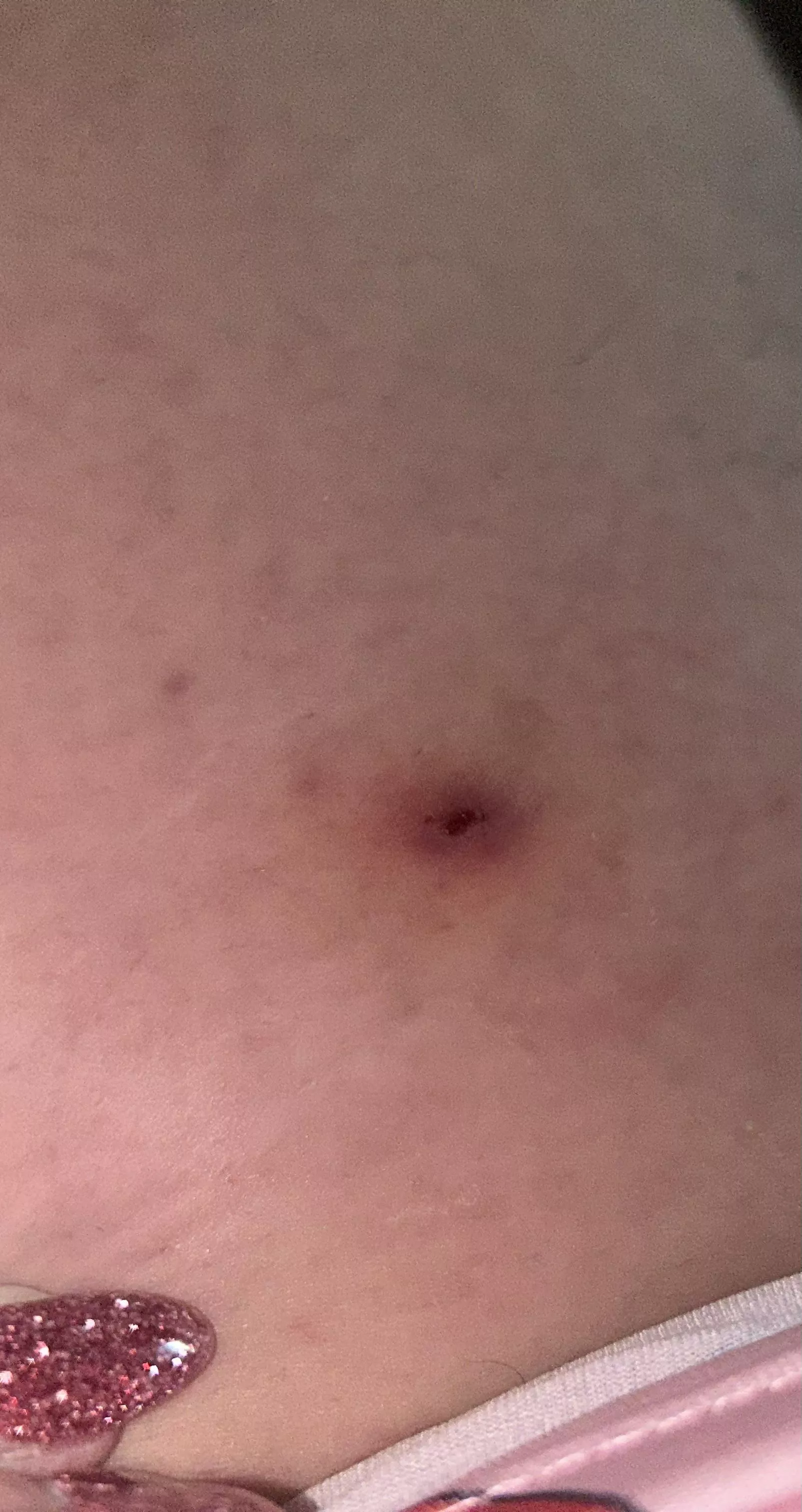 Help??? Does this look like an ingrown hair?? On upper thigh 