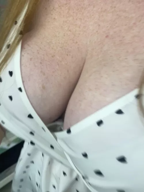 So many freckles! 😊