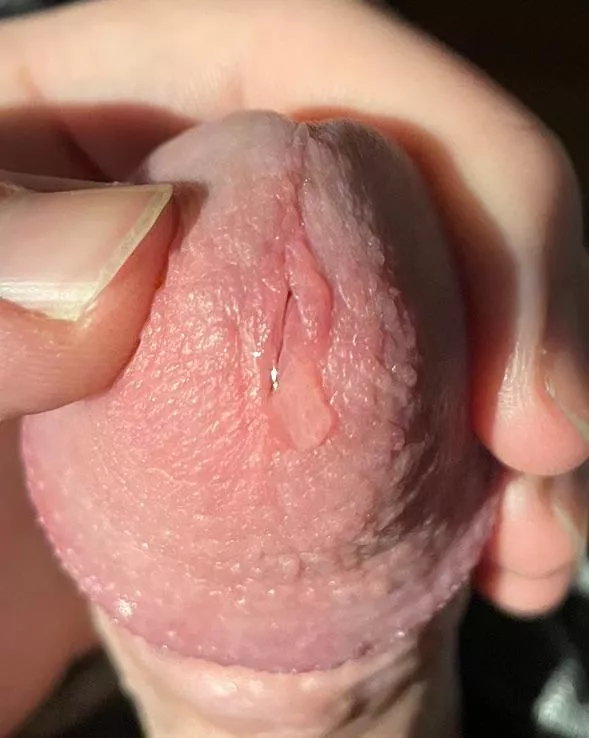 This is only a little bit