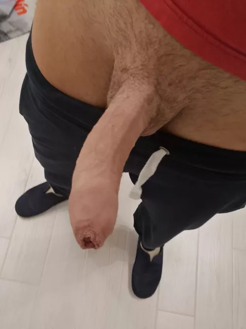 Tight foreskin
