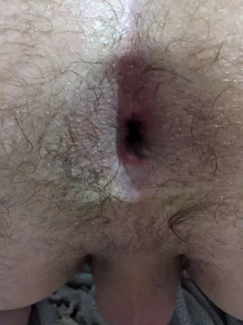 Wife fisting me 🤤