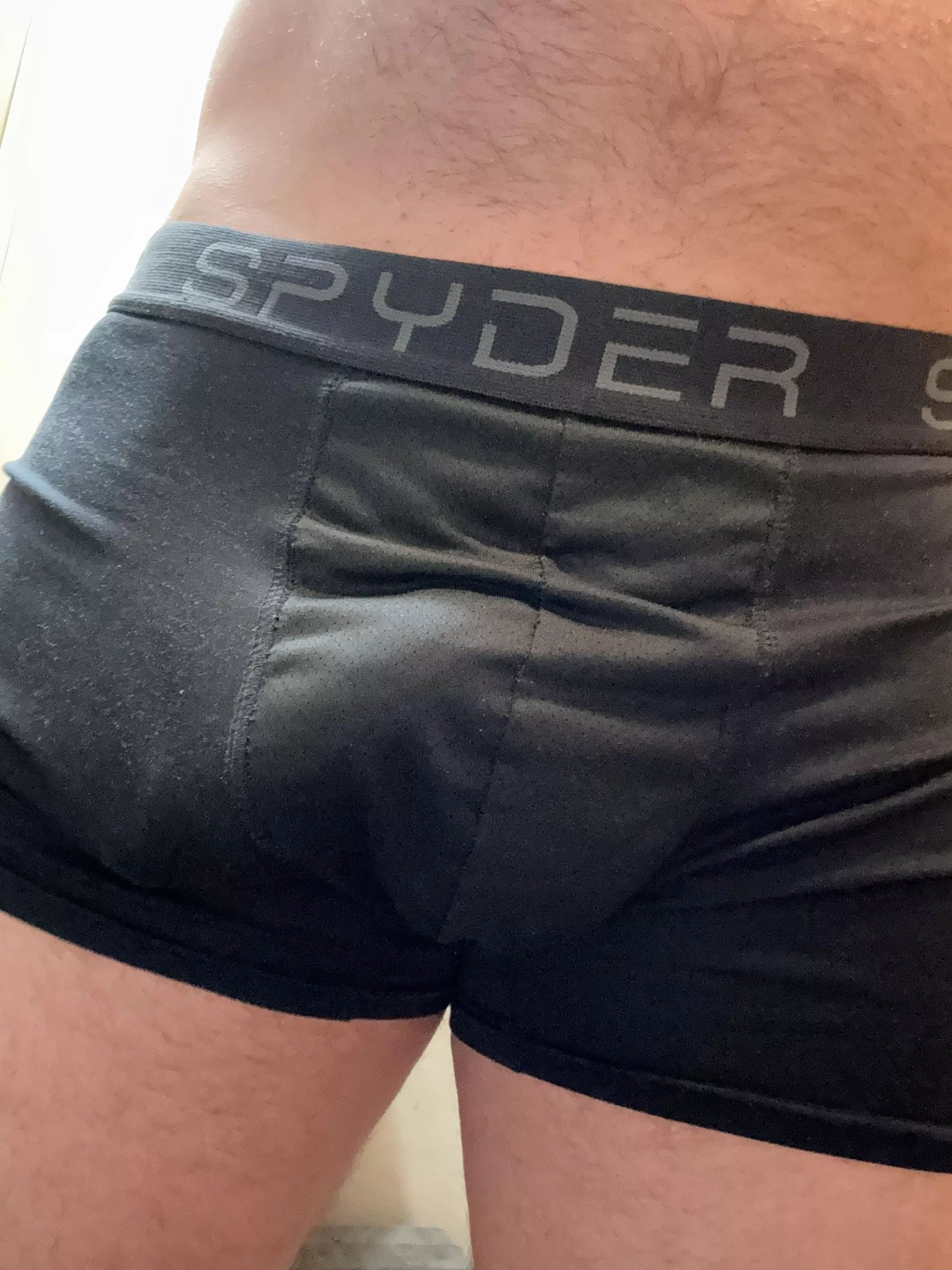 Can you see where it ends (soft bulge)
