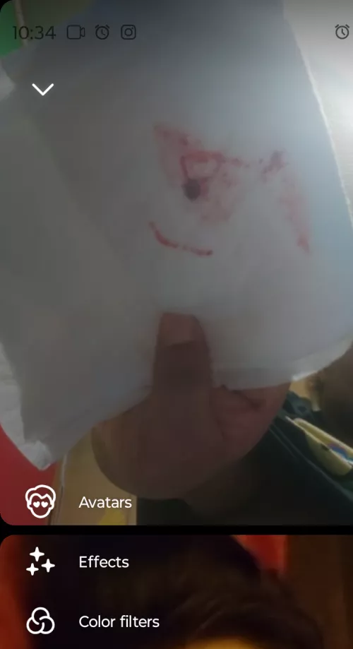 My boyfriend showed me the aftermath of the pimple that popped
