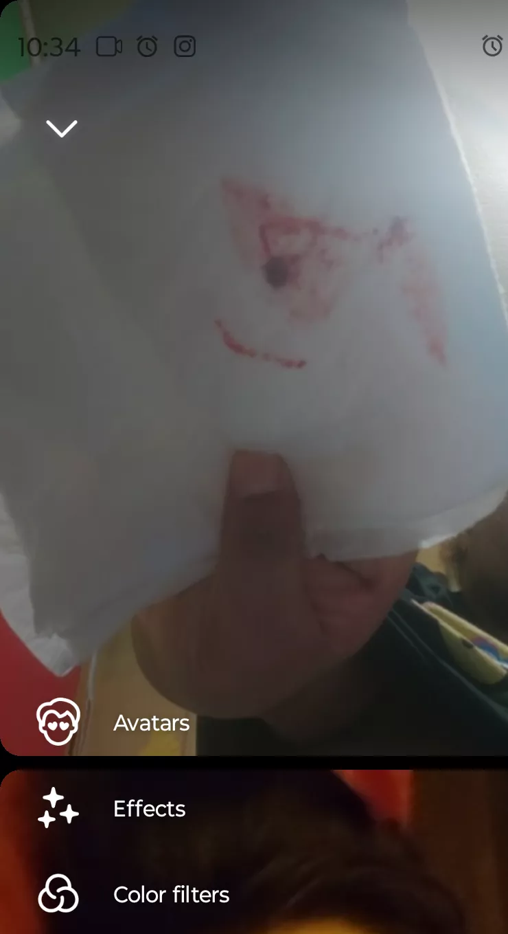 My boyfriend showed me the aftermath of the pimple that popped