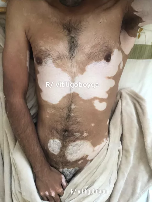 Never posted body pic before 🙄