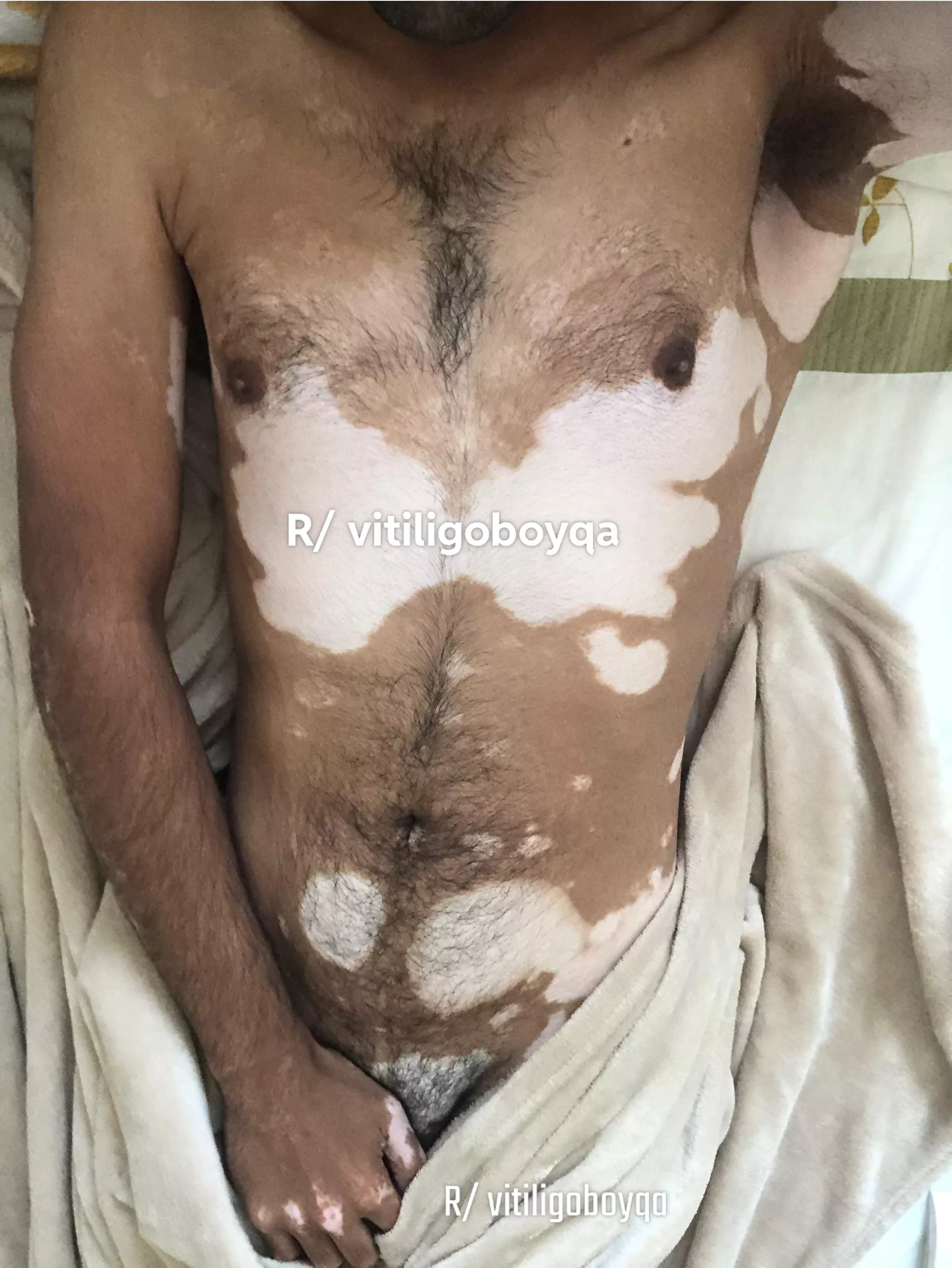 Never posted body pic before 🙄