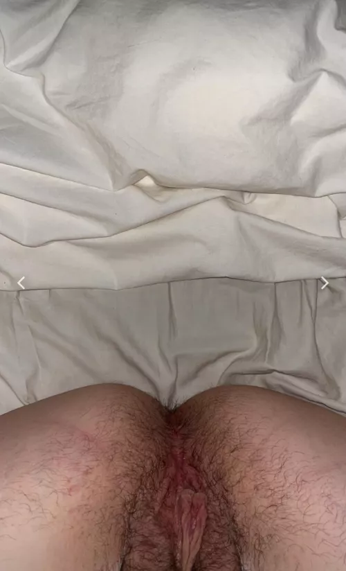 anyone with hairy kink? [h]
