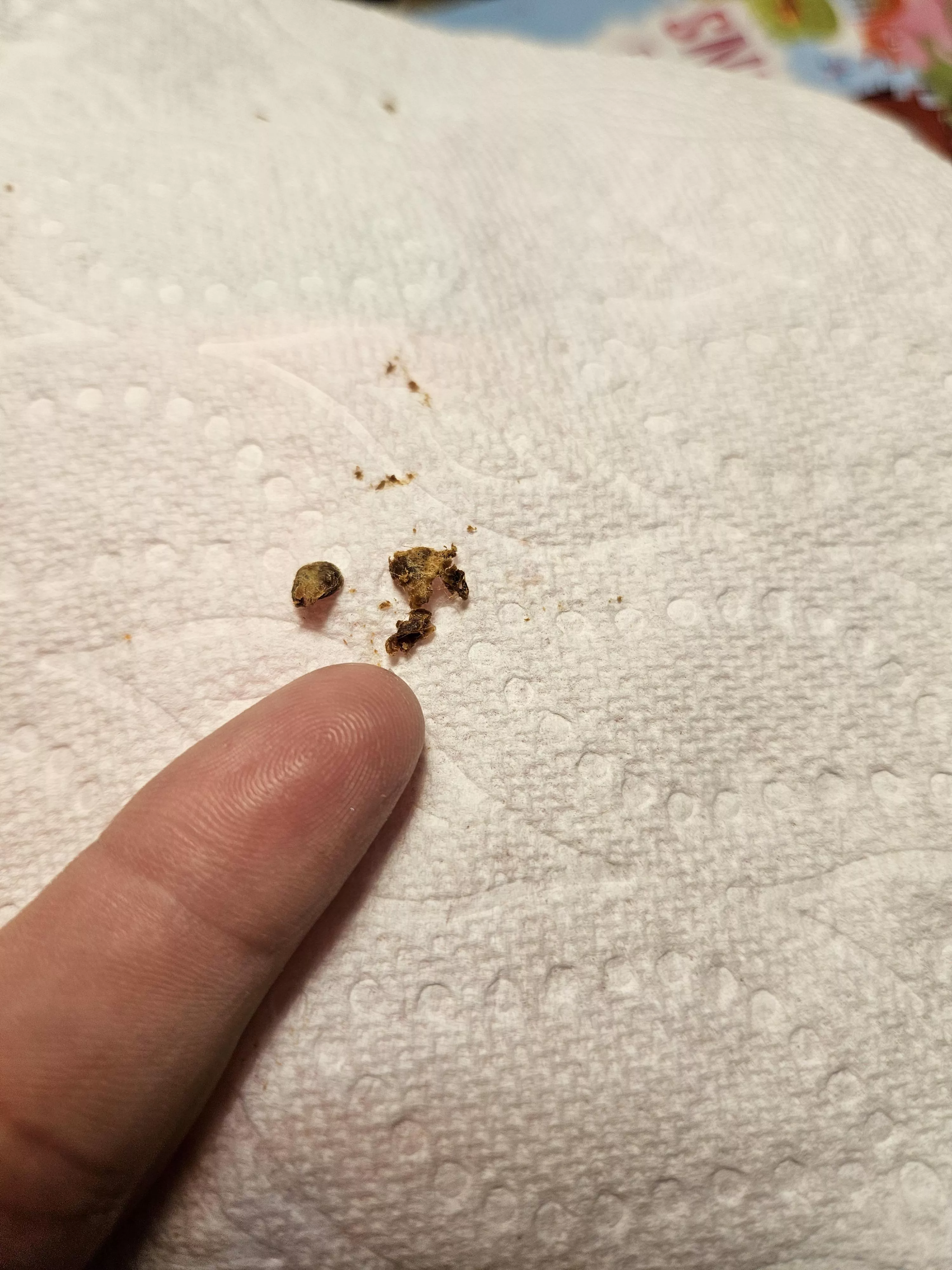 Got an ear camera and pulled this out of my ear. I can hear colors