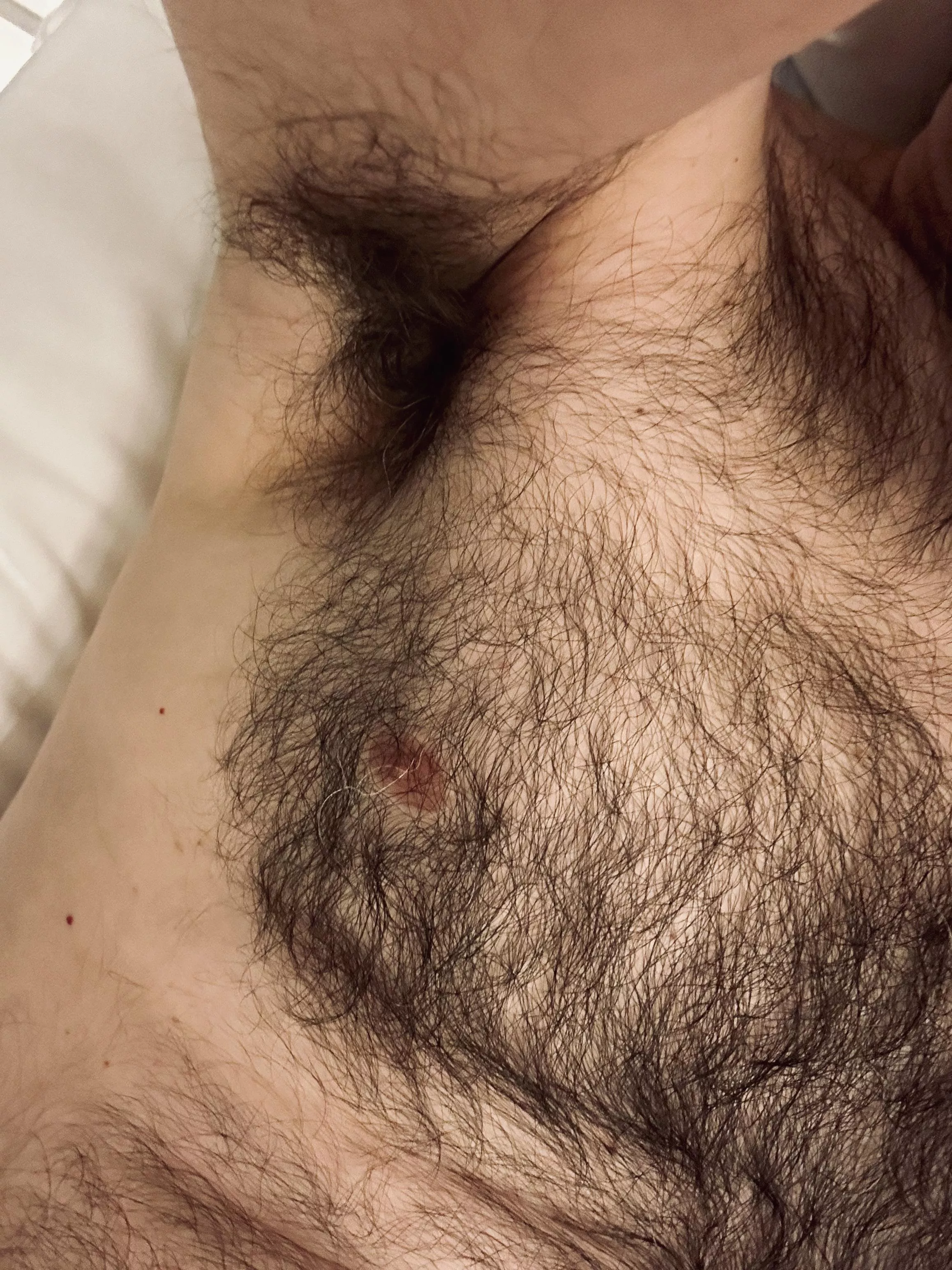 My pits blend into my tits...