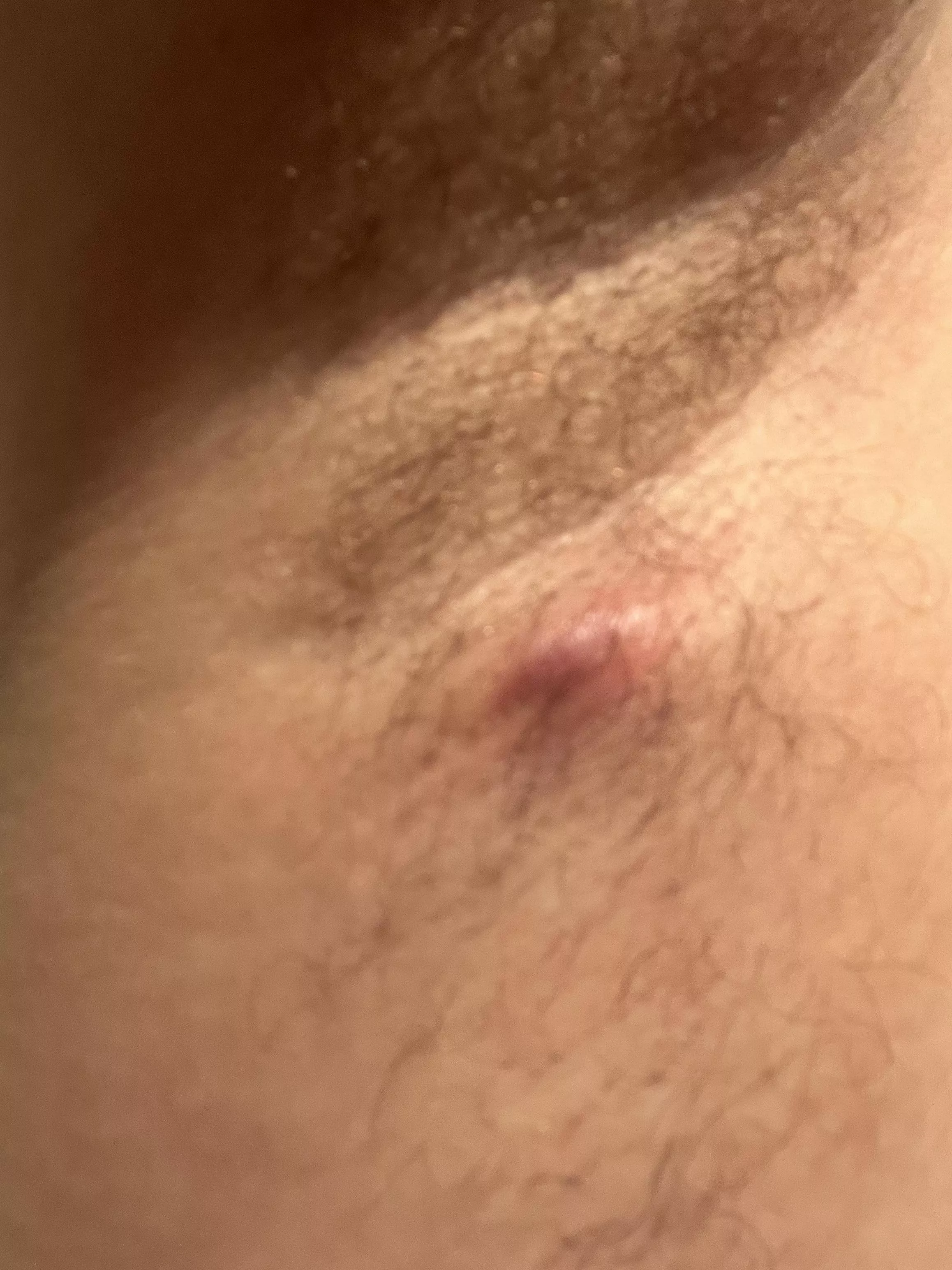 A guest appeared under the arm