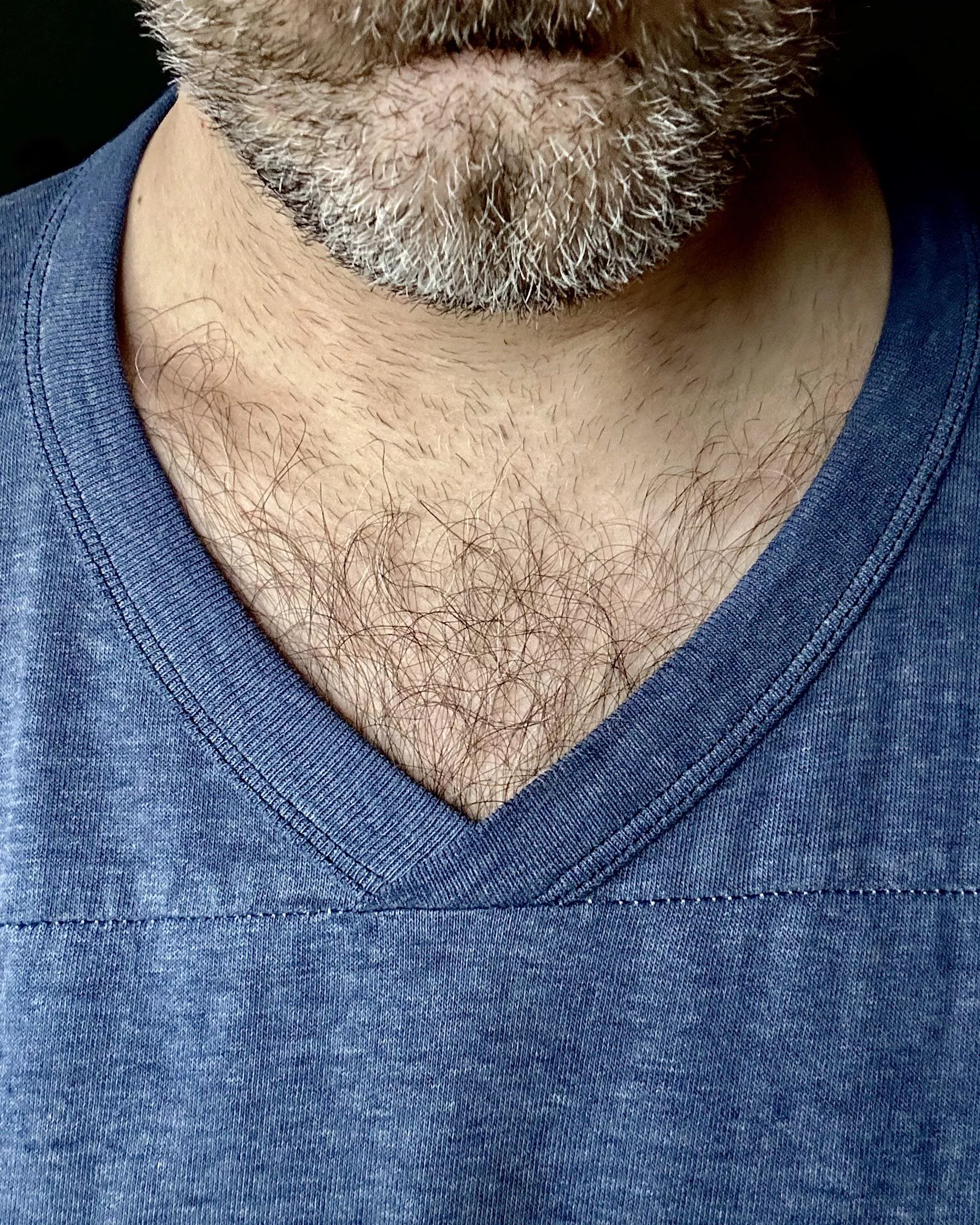 My chest hair meets my beard...