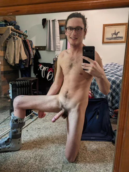 Am I still hot with a broken leg? 