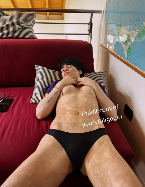 Xia (@yourvitiligogirl) [onlyfans]