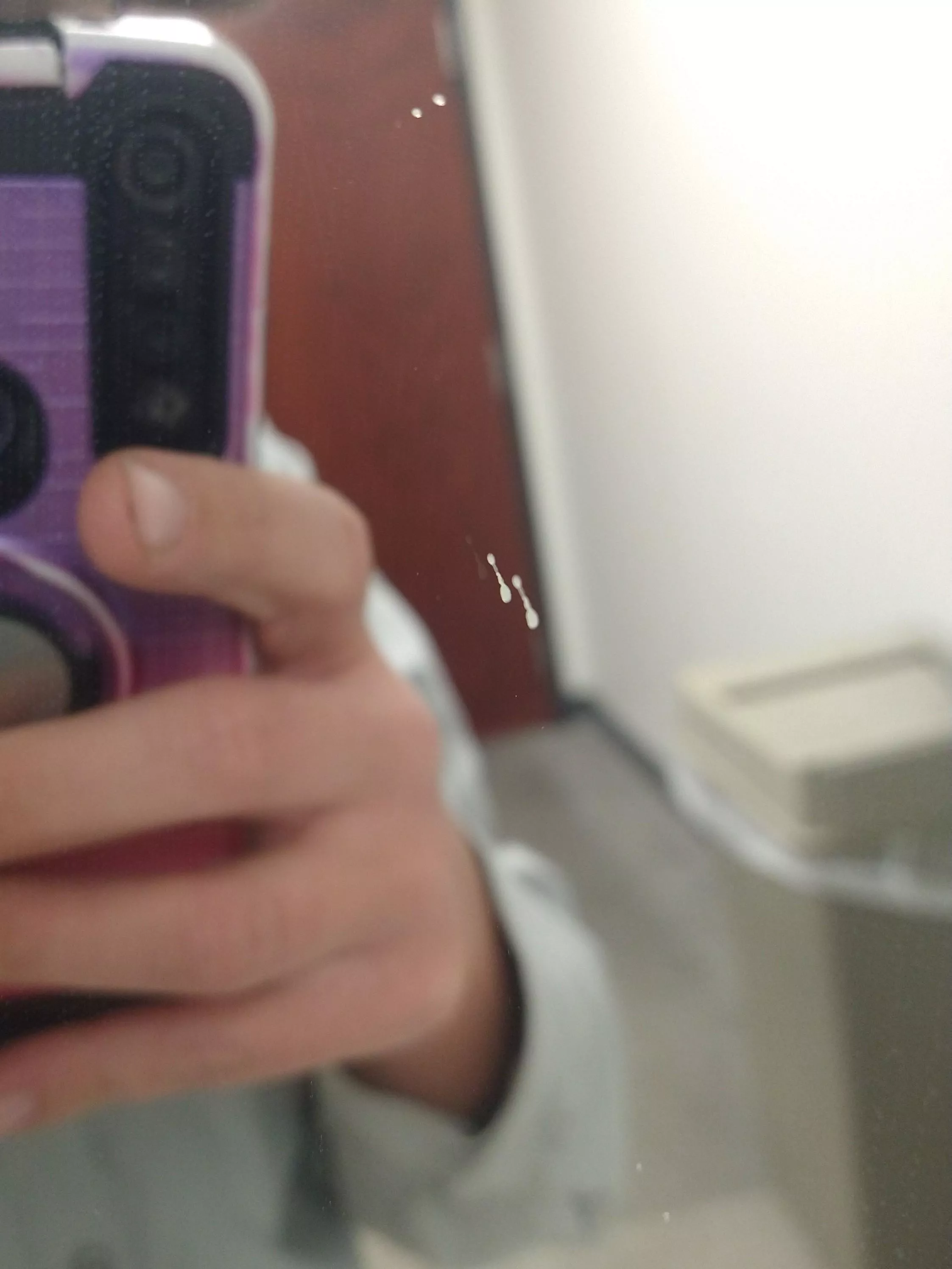 Had squeezed a sore spot on my chin a couple times to no avail, so I wasn't thinking to record it, but it had quite the trajectory and spread (there's the obvious pus dot at the top of the picture and also two harder-to-see ones at the bottom). Immense