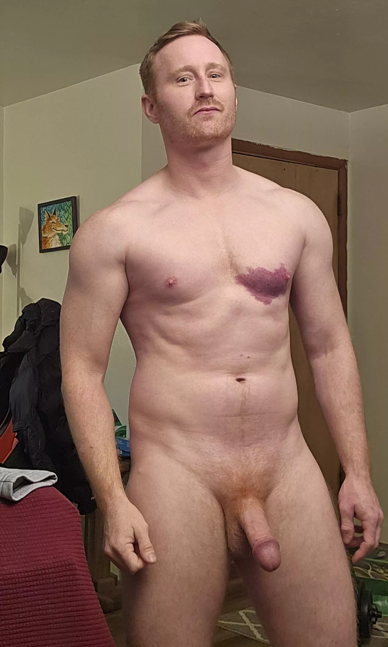 It's a birthmark and I call it my bleeding heart