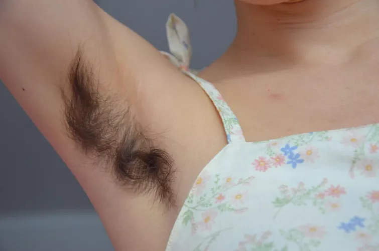 Sorry for the weird question, but do you think my hair looked normal or growing weird?🙈