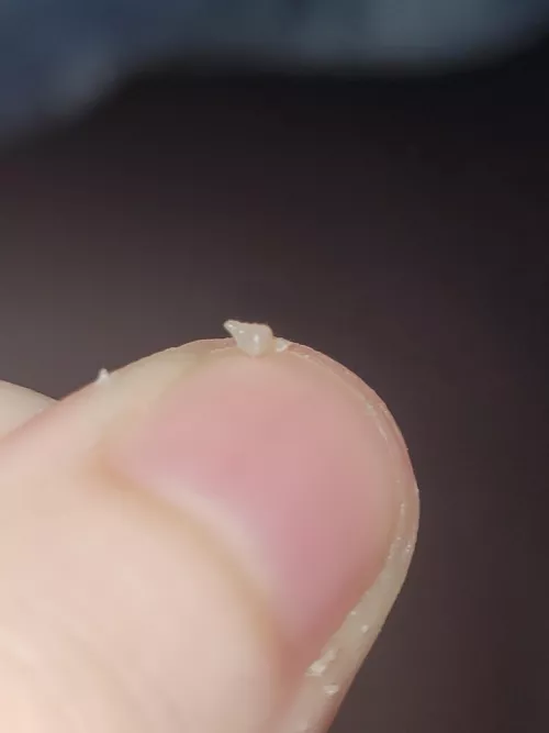 This came out of my piercing today