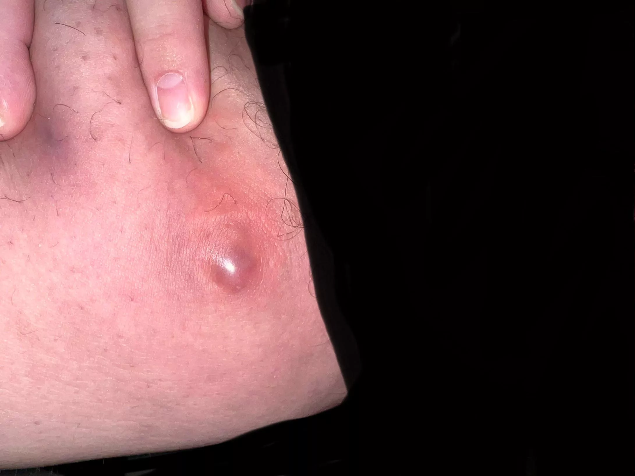 Just fucking pop already